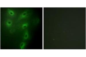 Immunofluorescence analysis of HeLa cells, using TRIM59 Antibody.
