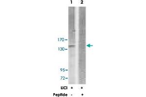 Western blot analysis of extracts from 293 cells, treated with LiCl (0. (ERBB3 antibody)
