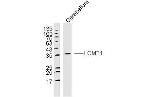 Mouse cerebellum lysates probed with LCMT1 Polyclonal Antibody, unconjugated  at 1:300 overnight at 4°C followed by a conjugated secondary antibody at 1:10000 for 90 minutes at 37°C. (LCMT1 antibody  (AA 45-150))