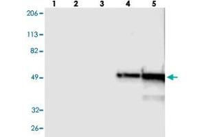 Western blot analysis of Lane 1: RT-4, Lane 2: U-251 MG, Lane 3: A-431, Lane 4: Liver, Lane 5: Tonsil with FGB polyclonal antibody . (Fibrinogen beta Chain antibody)