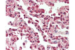 Anti-SF1 antibody IHC staining of human lung. (Splicing Factor 1 antibody  (AA 65-114))