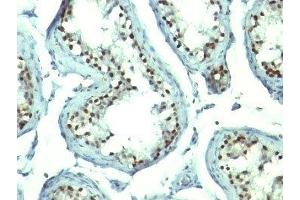 Immunohistochemistry (IHC) image for anti-Nucleolin (NCL) antibody (ABIN3025707)