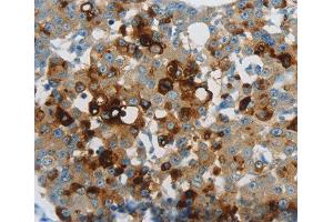 Immunohistochemistry (IHC) image for anti-Lipocalin 2 (LCN2) (AA 1-100) antibody (ABIN3017526) (Lipocalin 2 antibody  (AA 1-100))