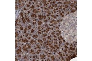 Immunohistochemical staining of human pancreas with NUDT22 polyclonal antibody  shows strong cytoplasmic positivity in exocrine glandular cells at 1:20-1:50 dilution.
