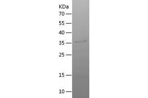 Western Blotting (WB) image for Synaptopodin 2-Like (SYNPO2L) (AA 181-465) protein (His tag) (ABIN7283315) (SYNPO2L Protein (AA 181-465) (His tag))