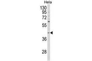Western blot analysis of NCK1 Antibody (N-term) in Hela cell line lysates (35ug/lane).