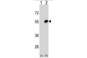 Western blot analysis of COCH (arrow) using rabbit polyclonal COCH Antibody (Center) . (COCH antibody  (Middle Region))