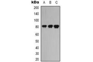 Western blot analysis of LRRC41 expression in K562 (A), rat kidney (B), rat heart (C) whole cell lysates. (LRRC41 antibody)