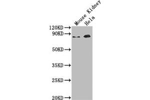 Western Blot Positive WB detected in: Mouse Kidney tissue, Hela whole cell lysate All lanes: Ripk1 antibody at 1:2000 Secondary Goat polyclonal to rabbit IgG at 1/50000 dilution Predicted band size: 75 kDa Observed band size: 75 kDa (RIPK1 antibody  (AA 1-656))