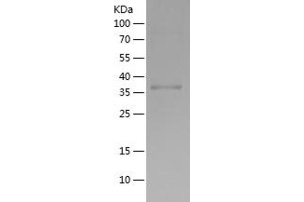 GDF2 Protein (AA 320-429) (His-IF2DI Tag)