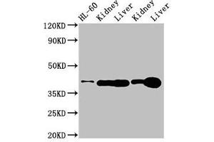 Western Blot Positive WB detected in: HL60 whole cell lysate, Rat kidney tissue, Rat liver tissue, Mouse kideny tissue, Mouse liver tissue All lanes: ADK antibody at 3 μg/mL Secondary Goat polyclonal to rabbit IgG at 1/50000 dilution Predicted band size: 41, 39, 35, 37 kDa Observed band size: 41 kDa (ADK antibody  (AA 18-256))