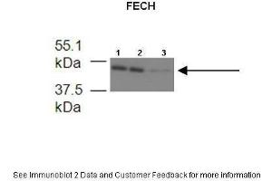 Lanes:   1. (FECH antibody  (Middle Region))