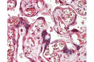 Human Placenta: Formalin-Fixed, Paraffin-Embedded (FFPE) (ADAM19 antibody)