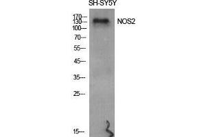 Western Blot (WB) analysis of specific cells using NOS2 Polyclonal Antibody. (NOS2 antibody  (Thr177))