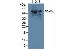 Western blot analysis of (1) Rat Liver Tissue, (2) Mouse RAW 2647 Cells and (3) Rat Brain Tissue. (TXNRD1 antibody  (AA 208-433))