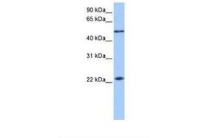 Image no. 1 for anti-Protein Inhibitor of Activated STAT, 2 (PIAS2) (AA 58-107) antibody (ABIN6738918) (PIAS2 antibody  (AA 58-107))