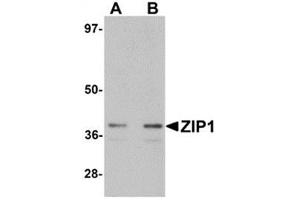 Western blot analysis of ZIP1 in mouse kidney tissue lysate with ZIP1 antibody at (A) 1 and (B) 2 μg/ml. (SLC39A1 antibody  (N-Term))