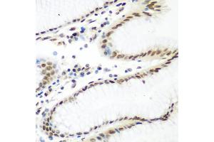 Immunohistochemistry of paraffin-embedded human stomach using CASP9 antibody (ABIN4903132) at dilution of 1:100 (40x lens). (Caspase 9 antibody)
