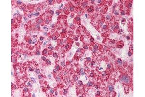 Anti-TST antibody IHC staining of human liver. (TST antibody  (Middle Region))