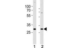 Western blot analysis of lysate from (1) SH-SY5Y and (2) MCF-7 cell line using HES1 antibody at 1:1000. (HES1 antibody  (C-Term))