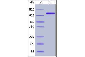 Human GM-CSF R alpha, Fc Tag on  under reducing (R) condition. (CSF2RA Protein (AA 23-320) (Fc Tag))