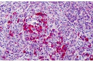 Human Pancreas: Formalin-Fixed, Paraffin-Embedded (FFPE) (GPR3 antibody  (C-Term))