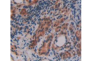 Used in DAB staining on fromalin fixed paraffin- embedded thyroid tissue (OSBP antibody  (AA 546-807))