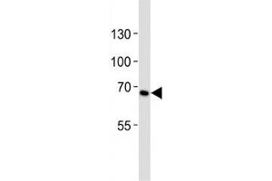 Western blot analysis of lysate from HeLa cell line using CD30 antibody diluted at 1:1000.
