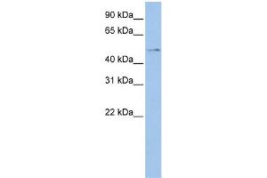 WB Suggested Anti-TSPYL4 Antibody Titration: 0. (TSPY-Like 4 antibody  (Middle Region))