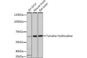 Western blot analysis of extracts of various cell lines, using Tyrosine Hydroxylase Rabbit mAb (ABIN1682210, ABIN3019364, ABIN3019365 and ABIN7101758) at 1:1000 dilution.