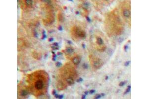 Used in DAB staining on fromalin fixed paraffin-embedded Liver tissue (PLA2G7 antibody  (AA 22-441))