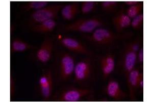 Image no. 1 for anti-Myc Proto-Oncogene protein (MYC) (pThr358) antibody (ABIN196674) (c-MYC antibody  (pThr358))