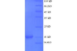 SDS-PAGE (SDS) image for Leptin (LEP) (AA 29-164), (partial) protein (His tag) (ABIN5712500)