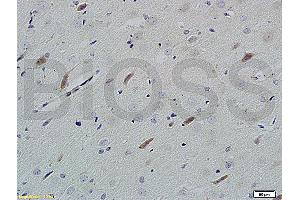 Formalin-fixed and paraffin embedded rat brain tissue labeled with Rabbit Anti-Neuroligin 1 Polyclonal Antibody (ABIN705311) at 1:200 followed by conjugation to the secondary antibody and DAB staining. (Neuroligin 1 antibody  (AA 701-800))