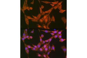 Immunofluorescence analysis of NIH-3T3 cells using LTH Rabbit mAb (ABIN7268244) at dilution of 1:100 (40x lens). (LTA4H antibody)