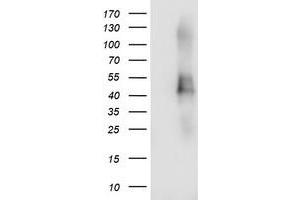Western Blotting (WB) image for anti-Transmembrane Protein with EGF-Like and Two Follistatin-Like Domains 2 (TMEFF2) antibody (ABIN1501417) (TMEFF2 antibody)