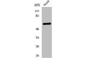 Western Blot analysis of HepG2 cells using Cytokeratin 5 Polyclonal Antibody (Cytokeratin 5 antibody  (C-Term))