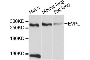 Western blot analysis of extracts of various cell lines, using EVPL antibody (ABIN5997700) at 1/1000 dilution.