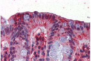 Human Colon (formalin-fixed, paraffin-embedded) stained with GAPDH antibody ABIN351435 at 2. (GAPDH antibody  (AA 51-100))