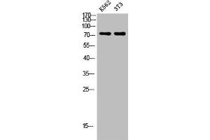 Western blot analysis of K562 3T3 lysate, antibody was diluted at 500. (Endoglin antibody  (AA 370-430))