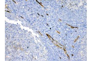 IHC analysis of Bcl-XL using anti-Bcl-XL antibody . (BCL2L1 antibody  (AA 1-219))