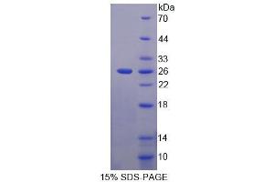 SDS-PAGE analysis of Human ACD Protein. (ACD Protein)