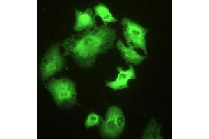 Detection of HSPA1A in A549 cells using Polyclonal Antibody to Heat Shock 70 kDa Protein 1A (HSPA1A) (HSP70 1A antibody  (AA 1-641))