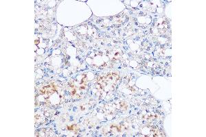 Immunohistochemistry of paraffin-embedded rat breast using MGP Rabbit pAb (ABIN6128268, ABIN6143825, ABIN6143826 and ABIN6221090) at dilution of 1:100 (40x lens). (MGP antibody  (AA 20-103))