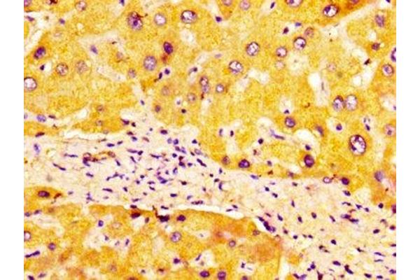 ULBP1 antibody  (AA 26-216)