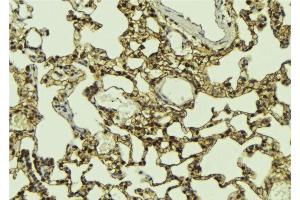 ABIN6274693 at 1/100 staining Mouse lung tissue by IHC-P.