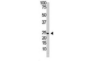 The IL29 polyclonal antibody  is used in Western blot to detect IL29 in Jurkat cell lysate.