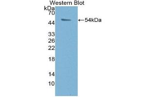 Western Blotting (WB) image for anti-Proteasome (Prosome, Macropain) 26S Subunit, ATPase, 1 (PSMC1) (AA 1-440) antibody (ABIN3204524)