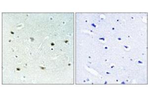 Immunohistochemical staining of human brain (left). (MAPK15 antibody  (pThr175, pTyr177))
