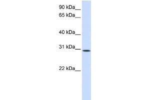 WB Suggested Anti-KIAA0247 Antibody Titration:  0. (SUSD6/KIAA0247 antibody  (N-Term))